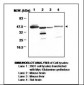 GLUL / Glutamine Synthetase Antibody